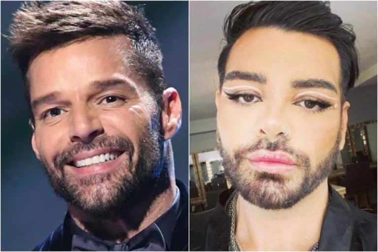 Argentino se realizó 30 cirugías para ser clon de Ricky Martin: “todos me amarían”