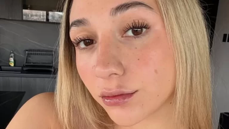 Carlita Inostroza muestra los resultados de drástico procedimiento estético: «¿Se operó o no? La veo igual que antes»